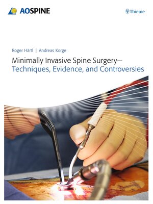 cover image of Minimally Invasive Spine Surgery--Techniques, Evidence, and Controversies